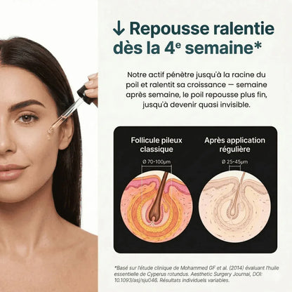 Ouravedo — Sérum Cyperus Rotundus Anti-Repousse