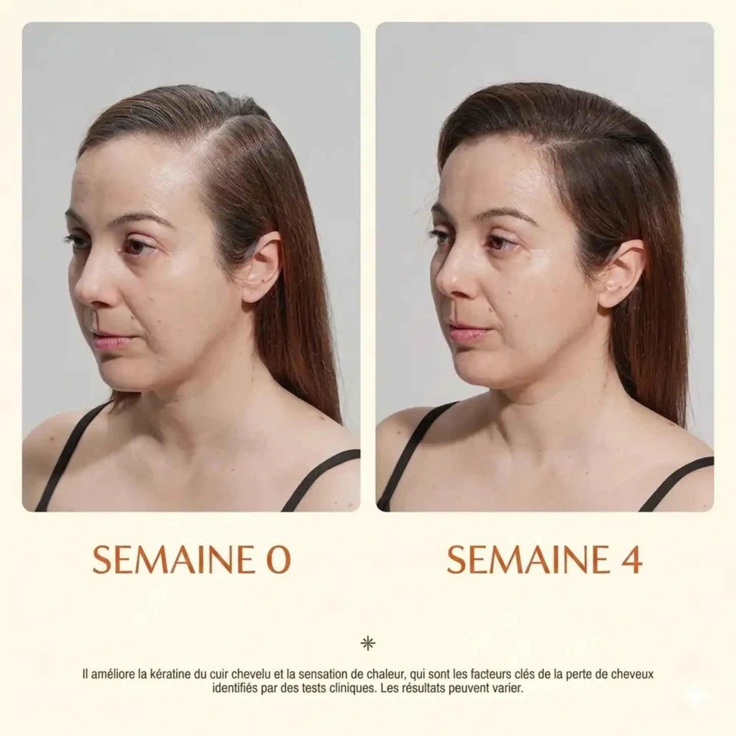 Ouravedo — Sérum Repousse Capillaire Anti-Chute