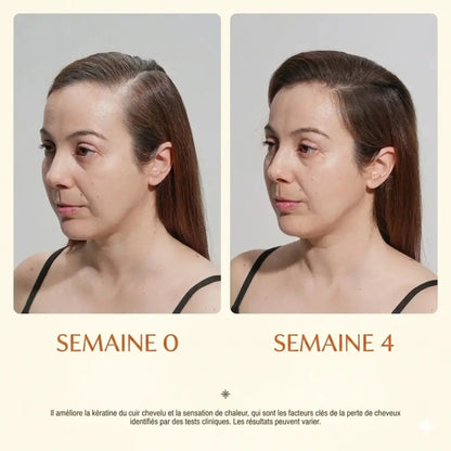 Ouravedo — Sérum Repousse Capillaire Anti-Chute