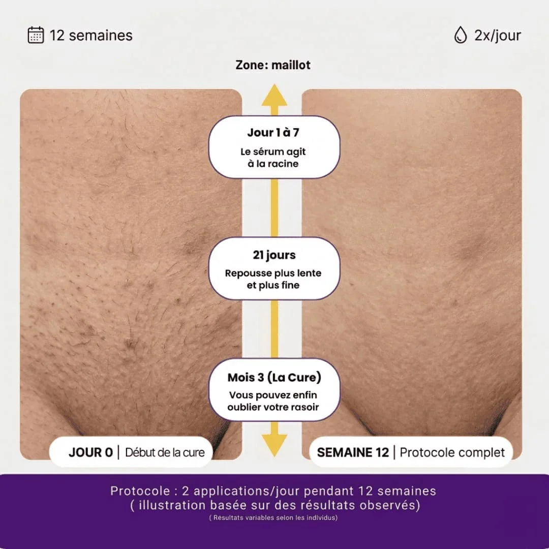 Ouravedo — Sérum Cyperus Rotundus Anti-Repousse